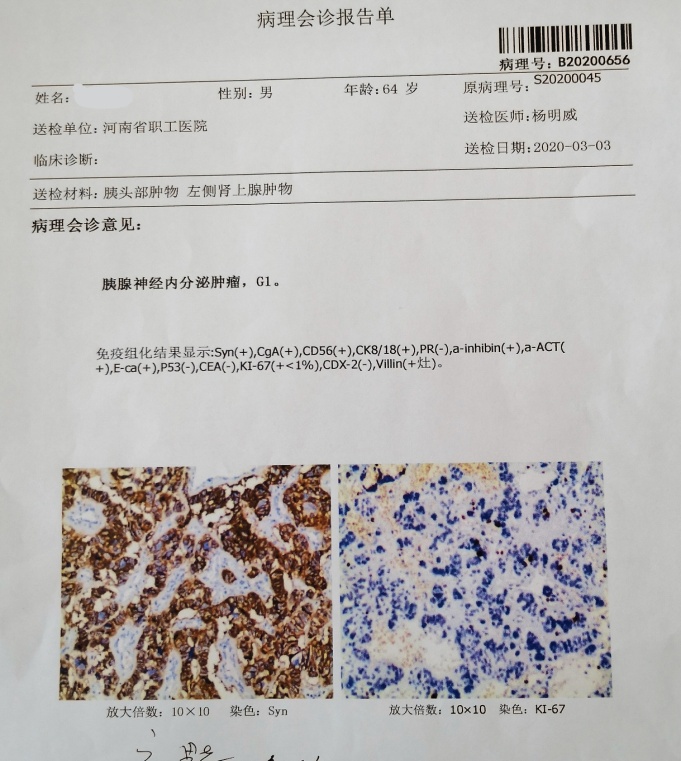 免疫组化结果.jpg