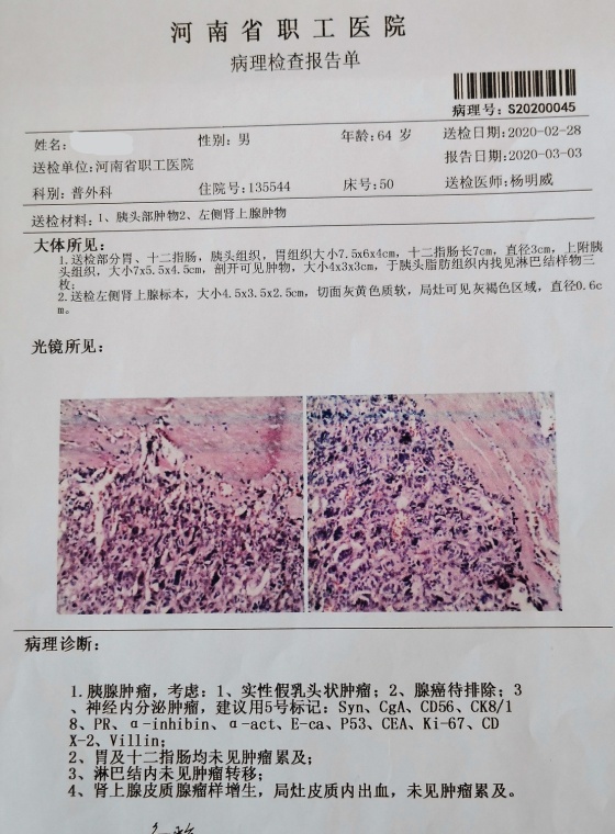 病理结果.jpg